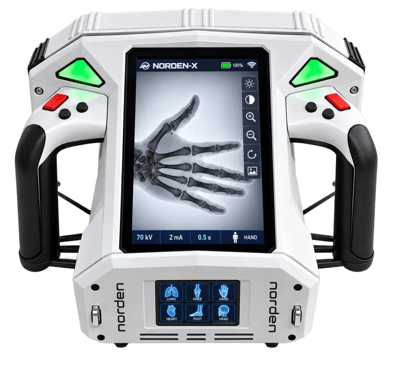 Norden HX5 Handheld X-Ray